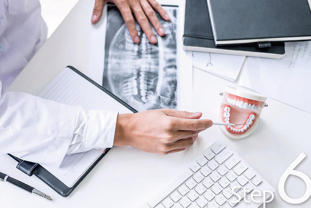 法夏爾來看牙 Allon4手術當天流程 工作區域 1 複本 8