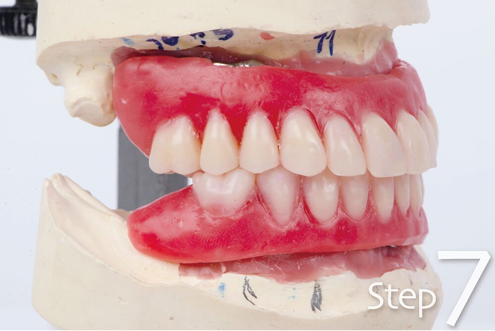 法夏爾來看牙 Allon4手術當天流程 工作區域 1 複本 9