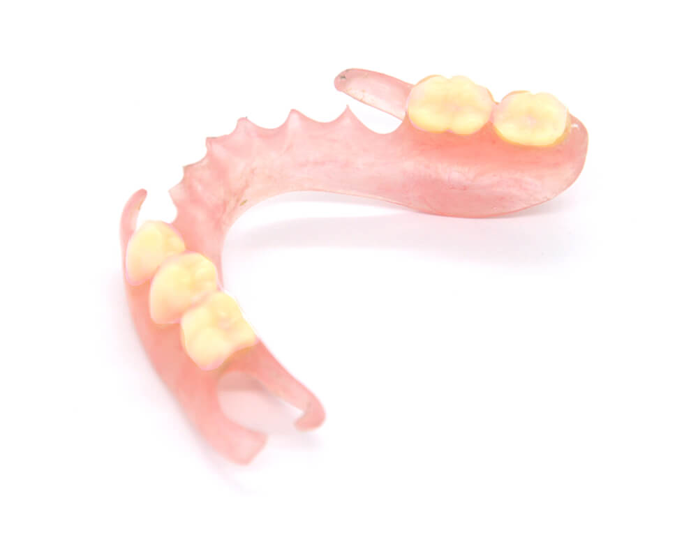 ▲樹脂支架活動假牙（彈性床）。