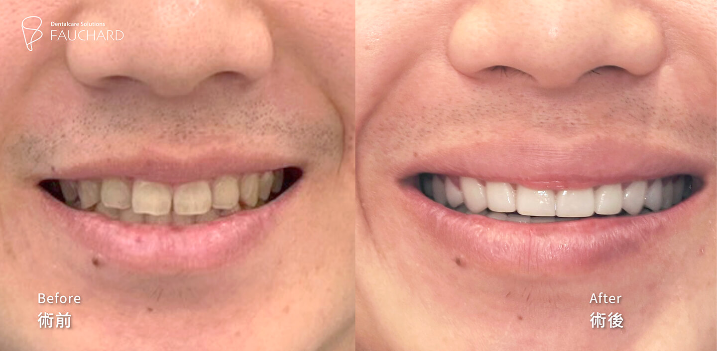 huang zi peng 260324 07